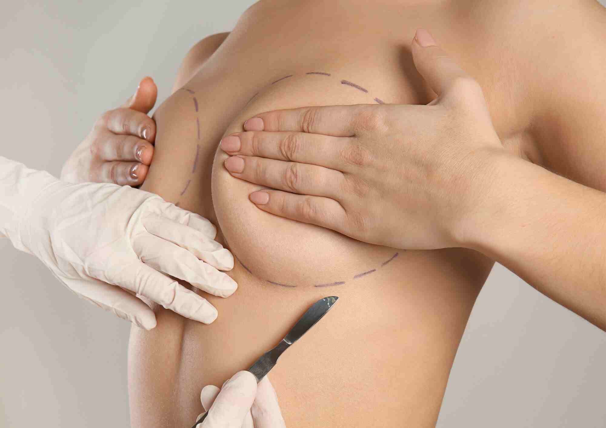 breast enlargement malaysia
